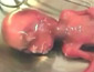 Aborted Human Fetus